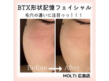 モルティー 広島店(Molti)/毛穴の違いに注目