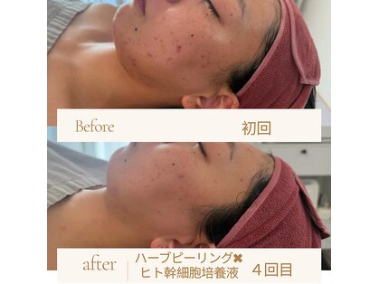 エム シャルール(M chaleur)の写真