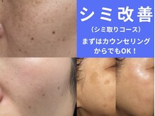 フェリス(FELIZ)の雰囲気（そのシミいつまで隠すの？隠す肌より魅せる肌へお手伝い致します）