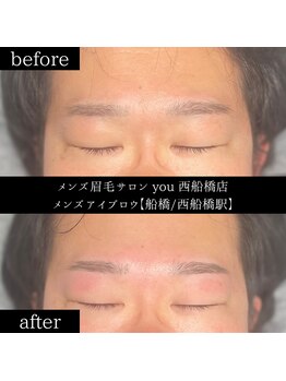 ユー 西船橋店(you)/ビフォーアフター写真