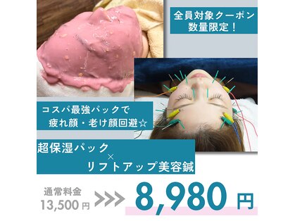 わきさか鍼灸整骨院・鍼灸院 レーヴ(Reve)の写真