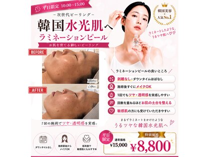 エステサロン アンジュール(Angelle)の写真