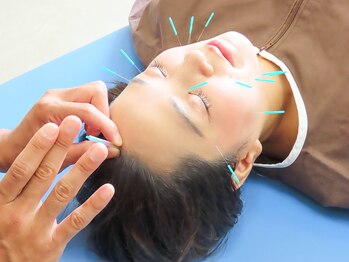 テイクケア(TAKEケア)/美容鍼