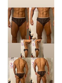 京橋メンズビューティーラボ(KMB LAB.)/ハイパーナイフのbefore/after