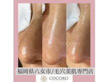 エイジングレスサロン ココロ 八女店(COCORO)の雰囲気（毛穴の黒ずみ、開き、汚れもスッキリ！）