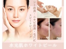 ジ エステティック イーズ ららぽーと福岡店