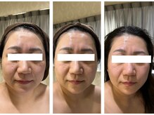 サロン ド スー(Salon de Suu)/ウルトランスフォーマー