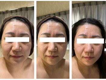 サロン ド スー(Salon de Suu)/ウルトランスフォーマー