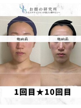 お顔の研究所/ビフォーアフター写真♪