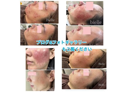 ビエル(Bielle)の写真