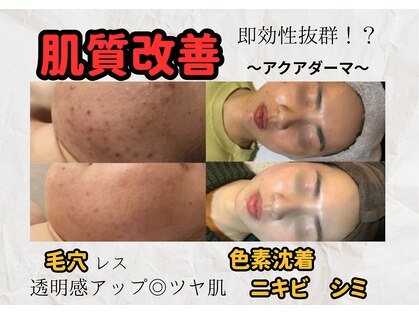 ココンフワット(Coconfouato)の写真