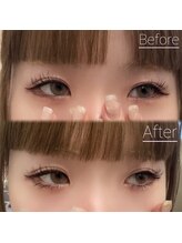 アレーヌ 中津店(Allene)/マツエク/まつパ/パリジェンヌ