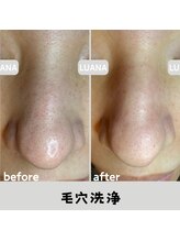 ルアナ 北谷店/毛穴洗浄毛穴ケア 《沖縄/北谷》