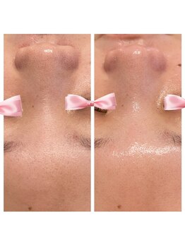 美温(mion)/水光肌