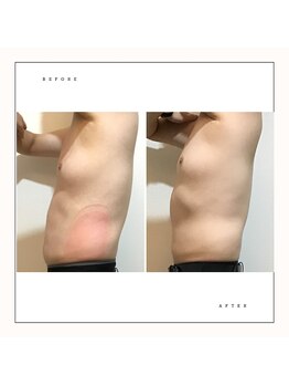 プレズィール 武庫之荘店(Plaisir)/モニター4カップ×3回