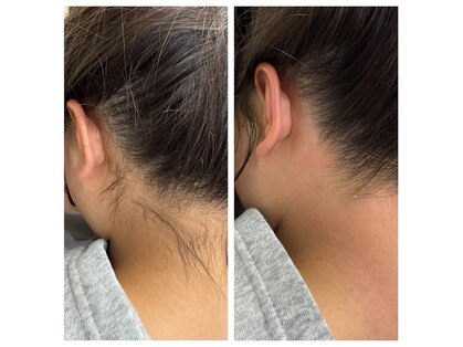 エピリア(Epilear)の写真