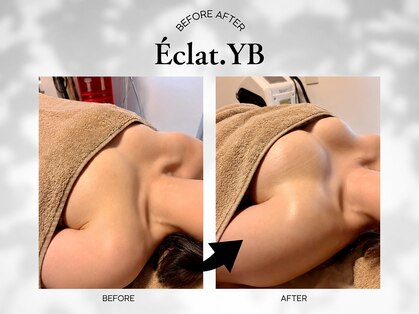 エクラワイビー(Eclat.YB)の写真