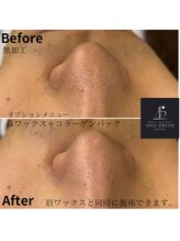 アンドブロウ 前橋(AND BROW)/眉毛メニューと一緒にできます！
