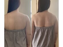 ミニョン(mignonn.)/