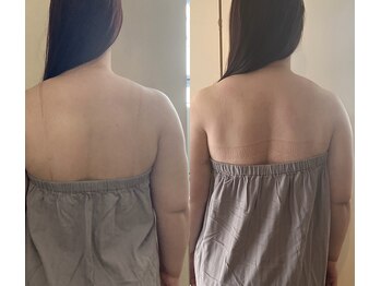 ミニョン(mignonn.)/