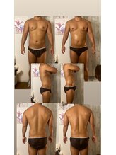 京橋メンズビューティーラボ(KMB LAB.)/ハイパーナイフのbefore/after