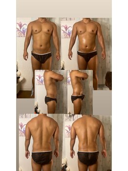 京橋メンズビューティーラボ(KMB LAB.)/ハイパーナイフのbefore/after