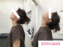 ボディメイク アールエフ サクラ接骨院(bodymake RF SAKURA接骨院)/肩特化施術　3