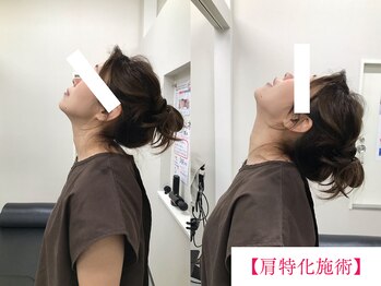 ボディメイク アールエフ サクラ接骨院(bodymake RF SAKURA接骨院)/肩特化施術　3