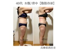 ルーチェエムベルシック(Luce.MBelChic)の雰囲気（気になる部分を【脂肪冷却】リバウンドの心配なし！）