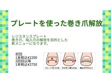 ネイルベース ネイル ケア サロン ミウラ(miura)の雰囲気（巻き爪解放施術始めました！すぐに効果を実感していただけます！）