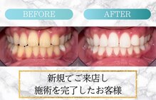 ロイヤル(ROYAL)