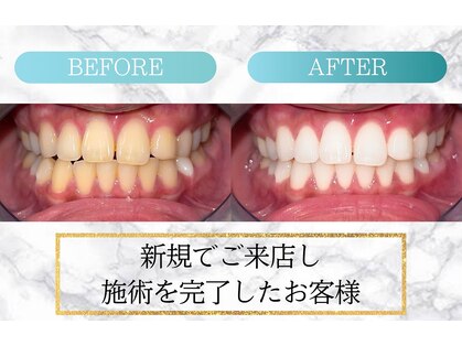 ロイヤル(ROYAL)の写真