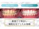 ロイヤル(ROYAL)の写真