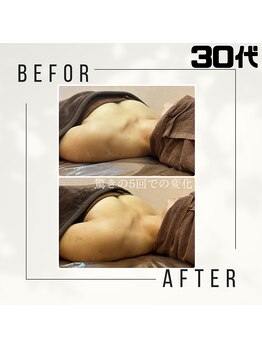 美 ワン(美 one)/プリンセスバスト