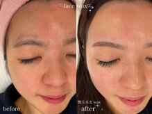 リュンヌ(LUNE)/当店オリジナル艶玉水光Wax