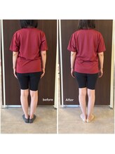 ニコディア(nico-dia)/全身矯正