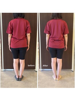 ニコディア(nico-dia)/全身矯正