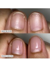 フェミニンネイル(Feminine Nail)/