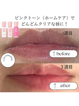 ユヌランコント 岐阜店(Une rencontre)/ピンクトーン（ホームケア）