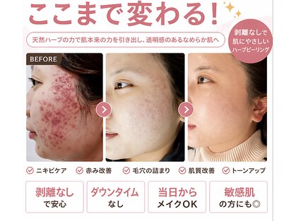 ブプラ 沖縄那覇店(BUPURA)の写真