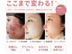 ブプラ 沖縄那覇店(BUPURA)の写真