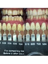 トウキョウスワーズ 池袋店(TOKYO SWRS)/#ホワイトニング #池袋 #渋谷
