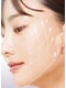 トータルエステティック レイ(Lay)の写真/【切らないリフト】話題の最新美容！全世代におすすめの切らないコラーゲン生成リフト♪初回お試し¥8800！