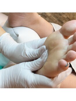 巻き爪補正店 鎌倉大船店/5.保湿クリーム・仕上げ