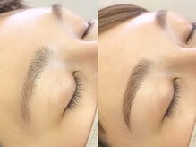 アフター(After)/パリジェンヌブロウリフト