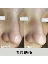 ルアナ 北谷店/毛穴洗浄毛穴ケア 《沖縄/北谷》