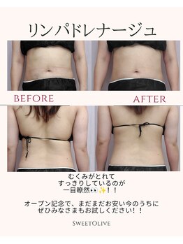 スウィートオリーブ 春日部(SweetOlive)/リンパドレナージュですっきり!