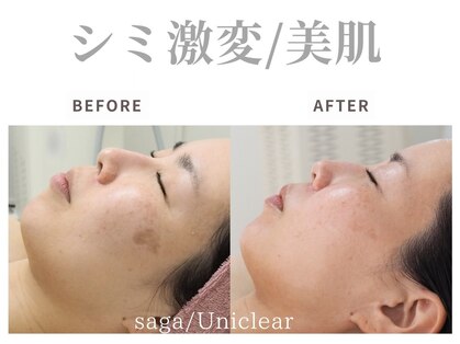 ユニクリア(Uni clear)の写真