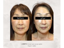 エスポワールカルド(Espoir caldo)/