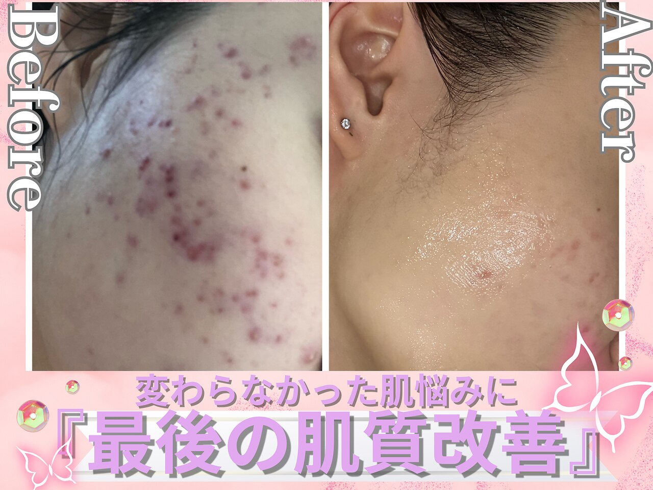 ボディ・フェイスケア NOA ノア 新宿(Noa)｜ホットペッパービューティー